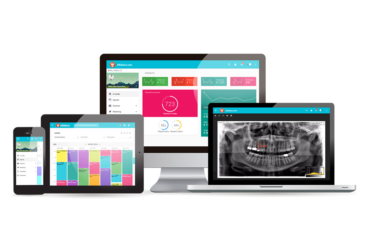 Faccette-dentali-elite-veneers-italia